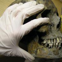 Décembre - Un examen de la dentition de 171 individus issus d'un cimetière de l'Âge Viking, en Suède, a révélé que plus de 60% des adultes étaient atteints de maladie carieuse, présentant de 1 à 22 caries. Qu'en est-il des enfants?