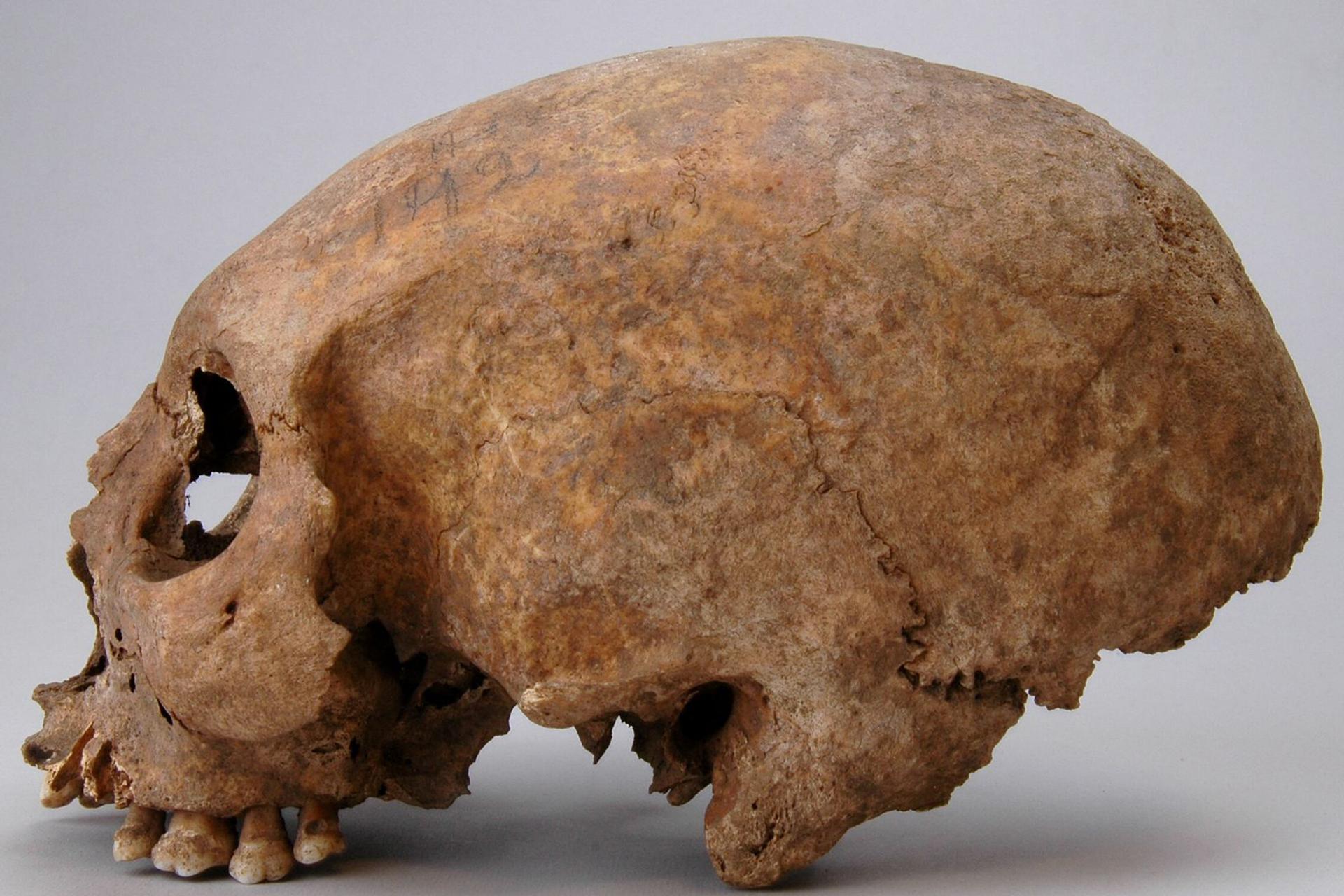 Suède - Le crâne allongé d'une femme découvert dans la tombe 192 de Havor, district de Hablingbo, à Gotland - Photo: SHM/Johnny Karlsson